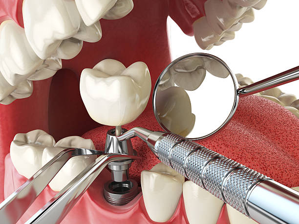 Best Emergency Orthodontic Repairs in Ashville, OH